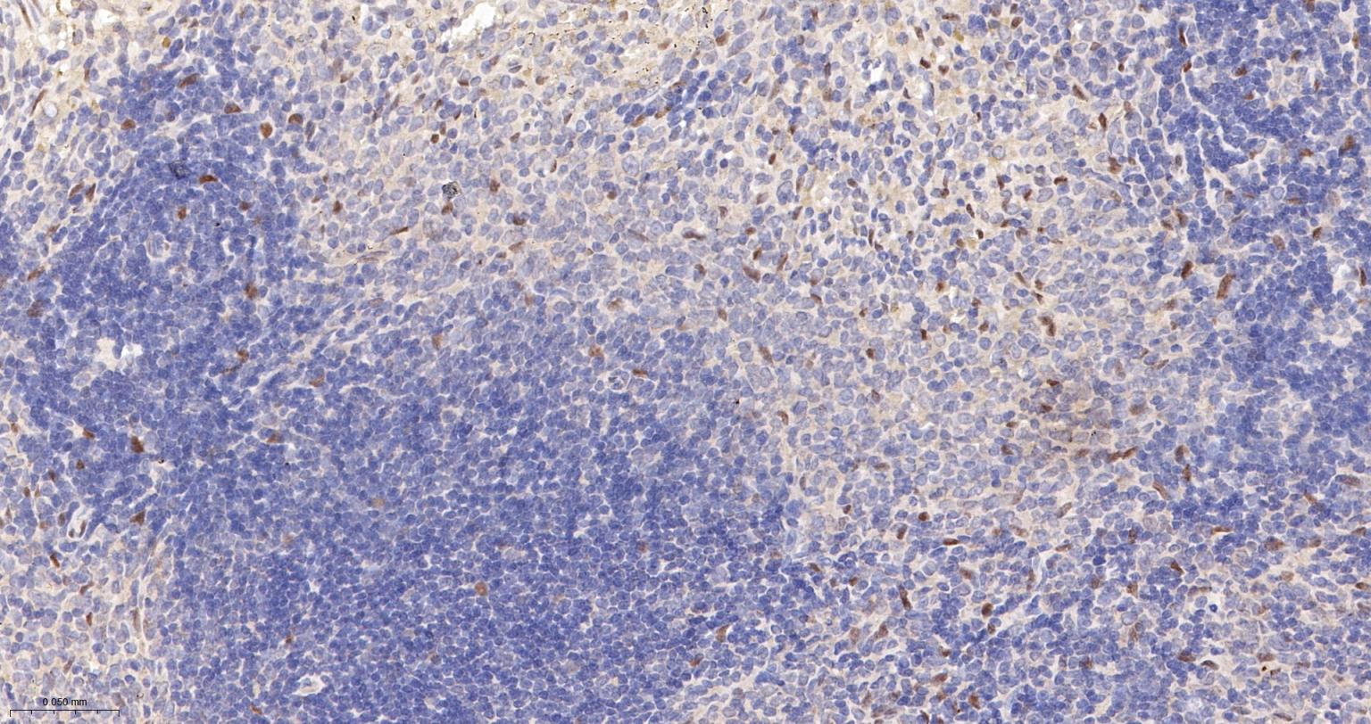 TEAD1重组兔单抗