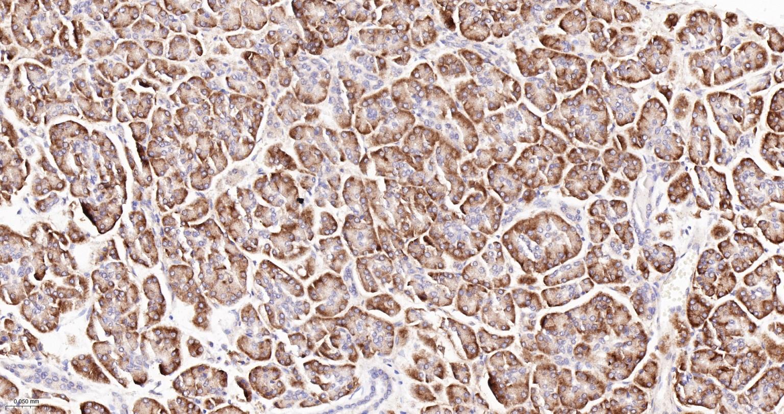 受体激活蛋白激酶C1重组兔单抗