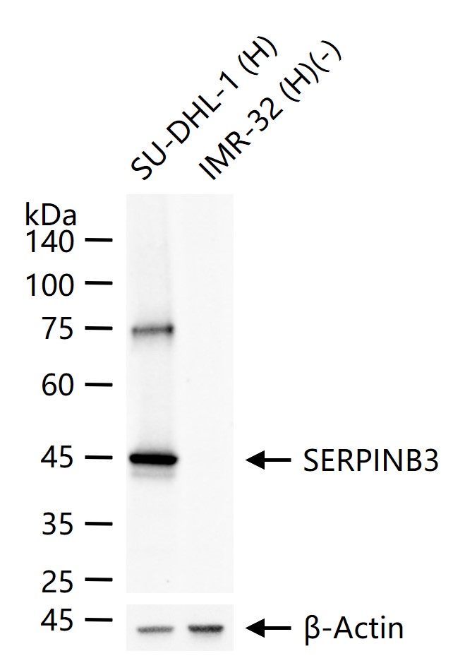 丝氨酸蛋白酶抑制剂B3重组兔单抗