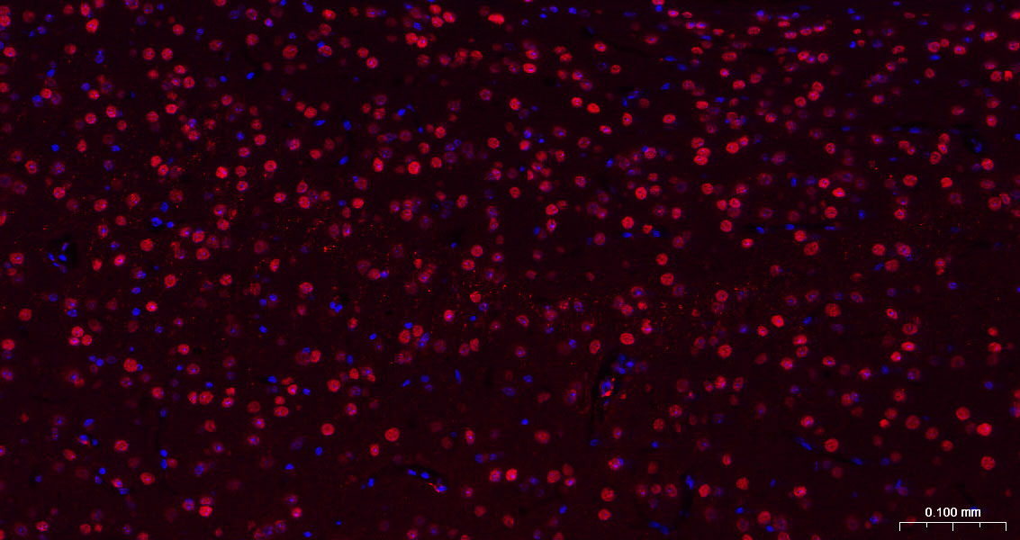 转录因子HES-1重组兔单抗-bsm-52568R