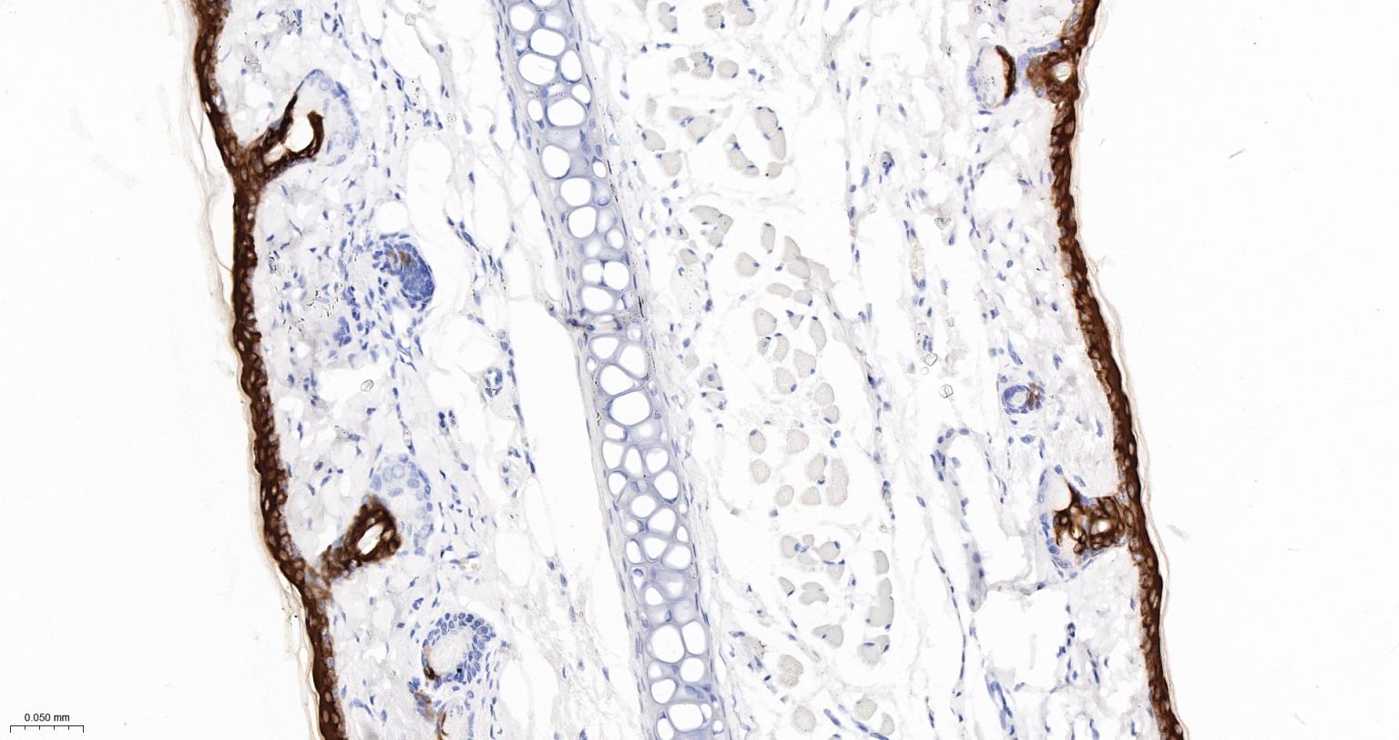 细胞角蛋白10重组兔单抗