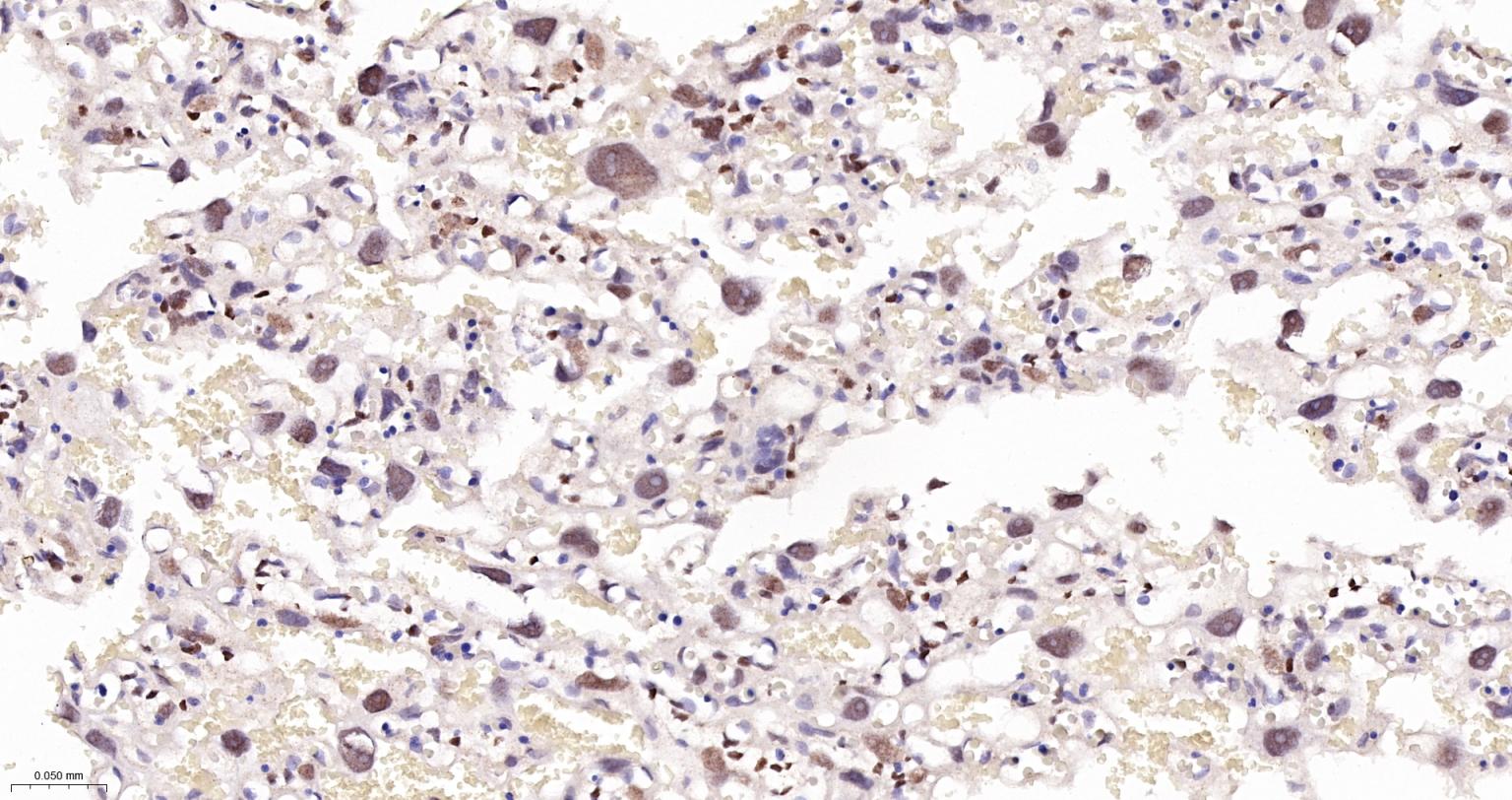 TEAD1重组兔单抗