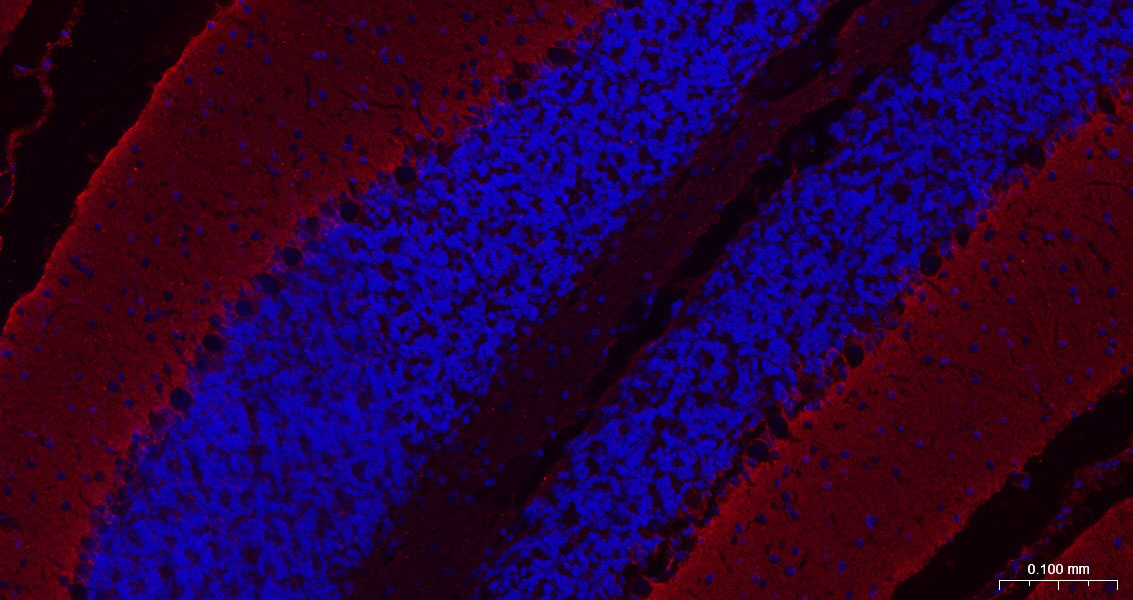 胶质细胞谷氨酸运载蛋白1重组兔单抗