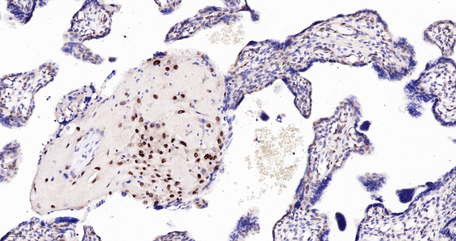 TEAD1重组兔单抗
