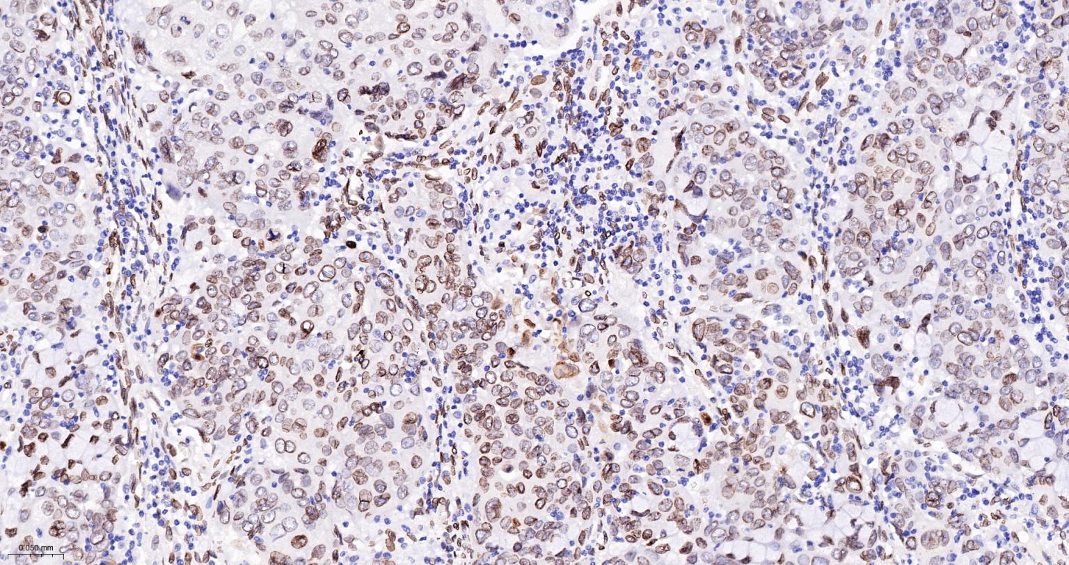 核纤层蛋白A/C单克隆抗体-bsm-51683M