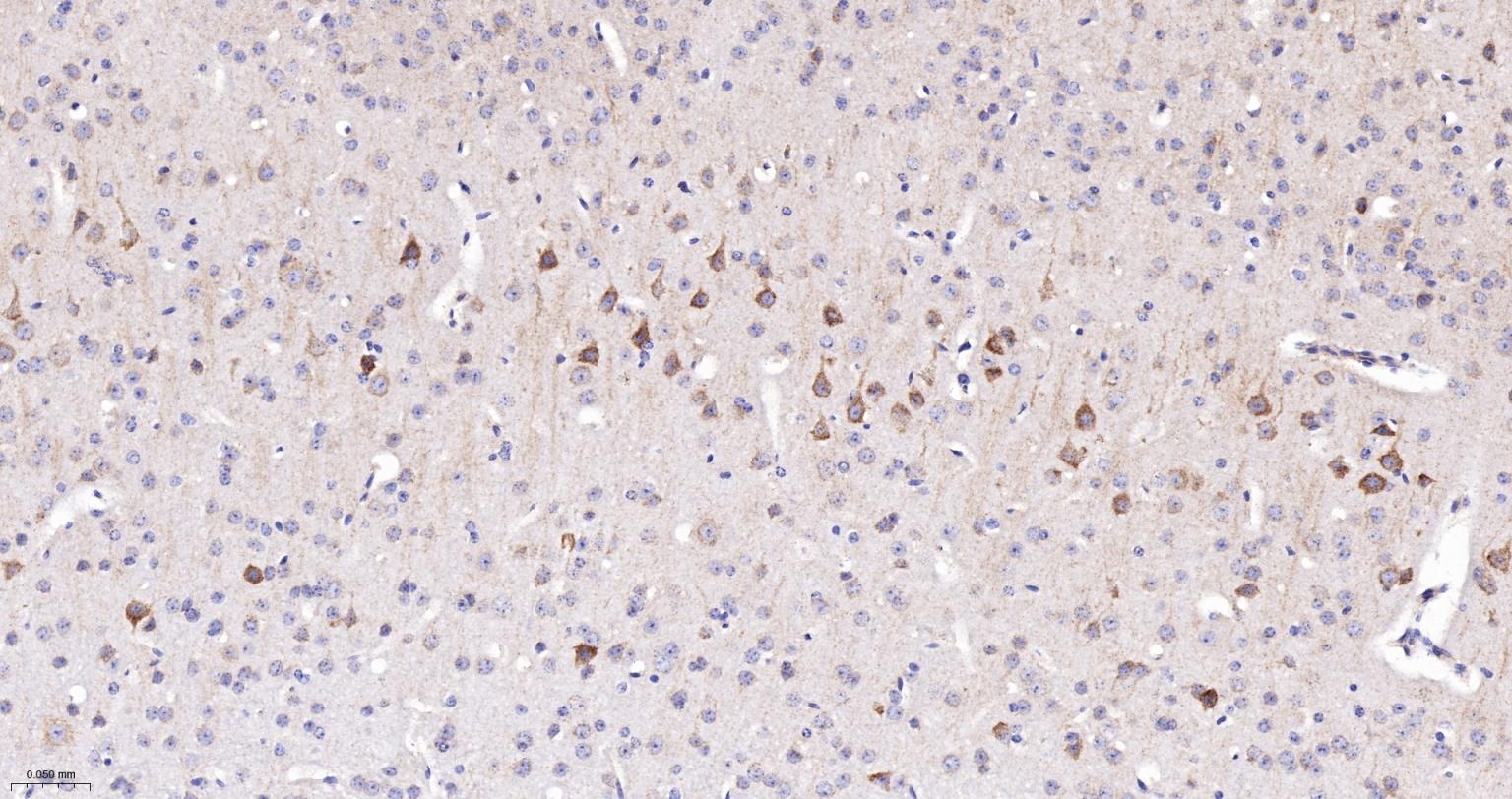 NDUFS2重组兔单抗