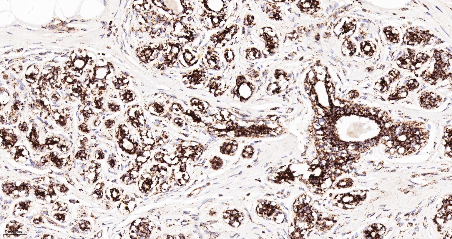 线粒体苹果酸脱氢酶2重组兔单抗