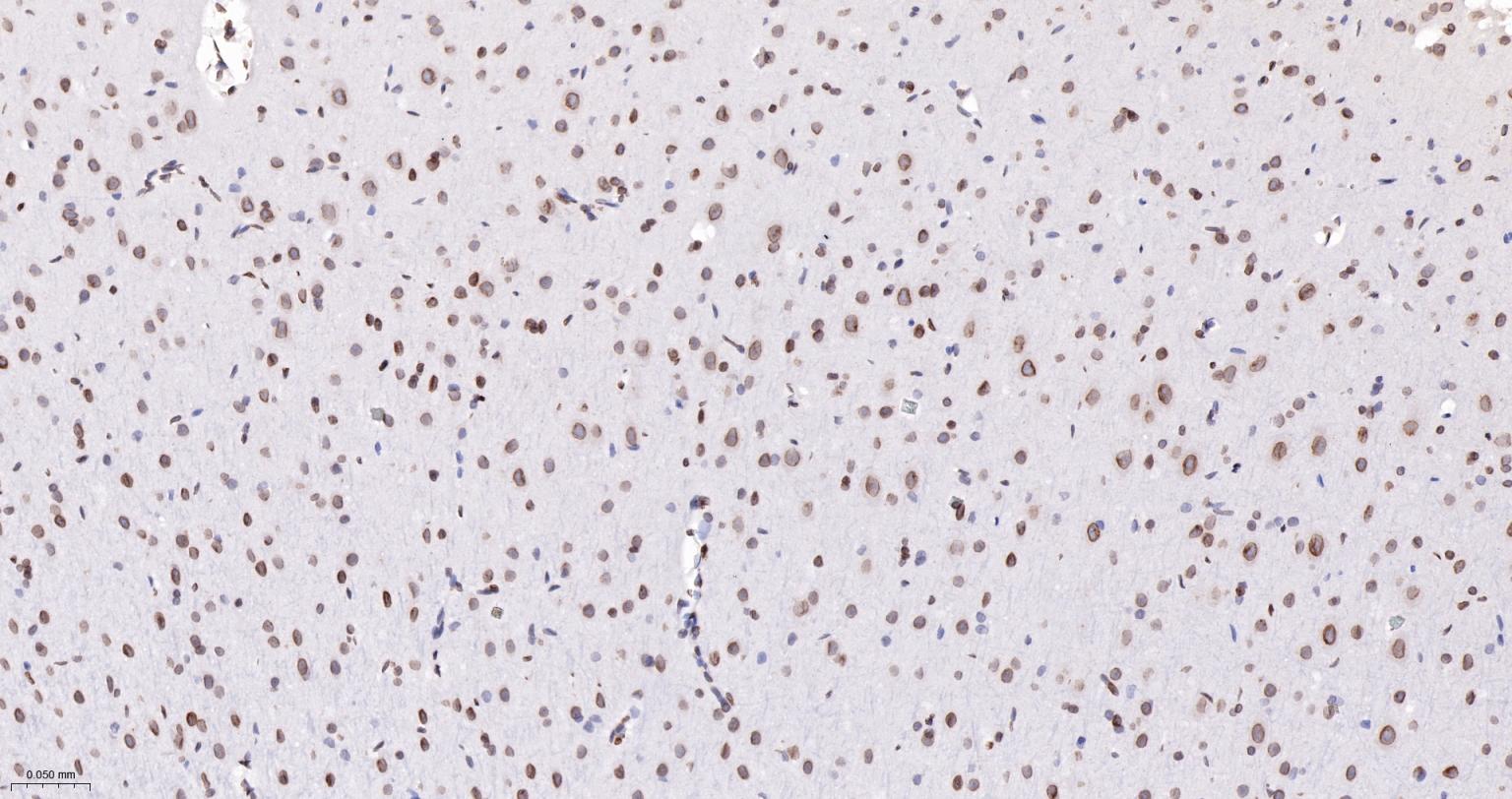 核纤层蛋白A/C单克隆抗体-bsm-51683M