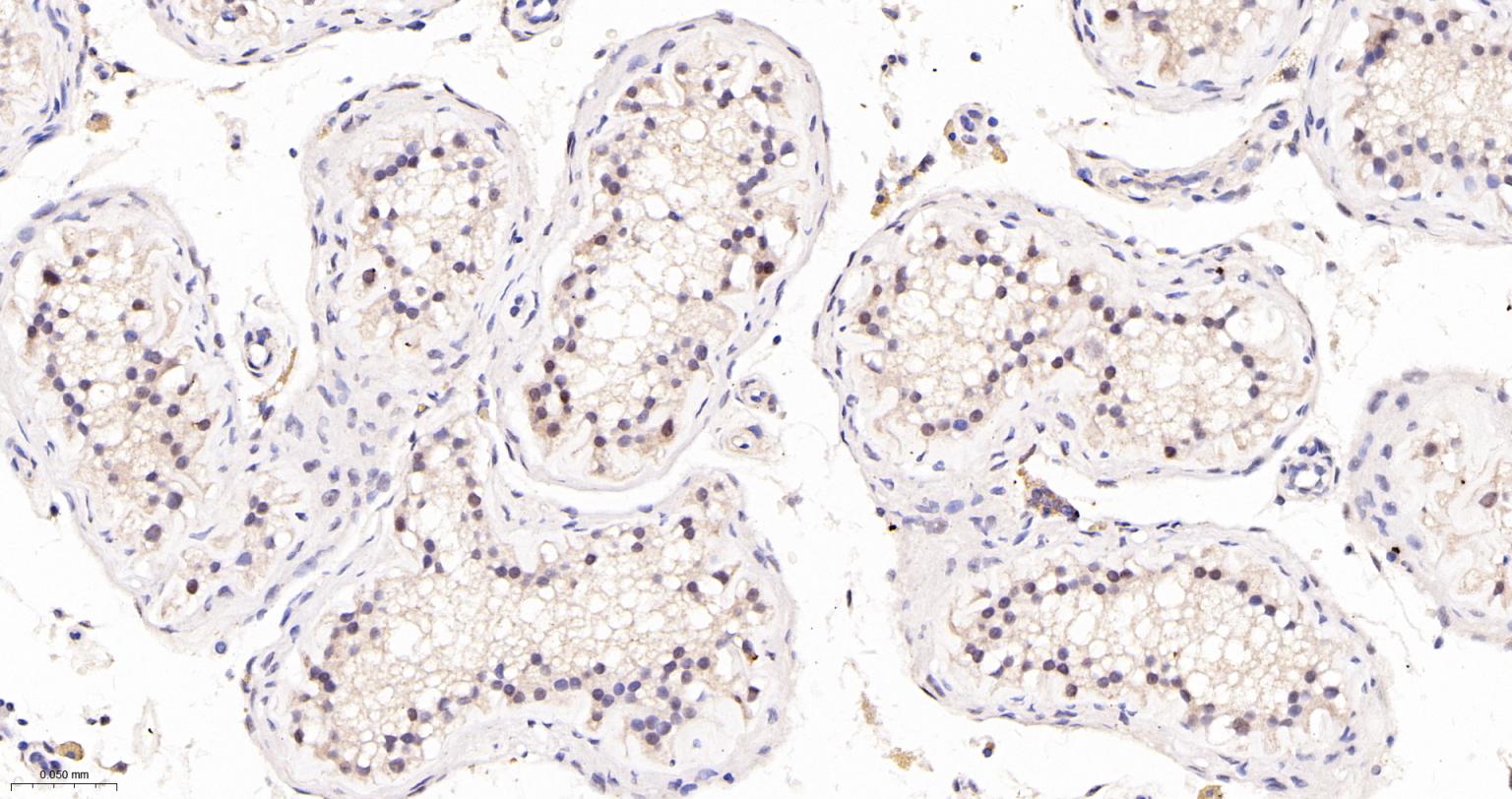 TEAD1重组兔单抗