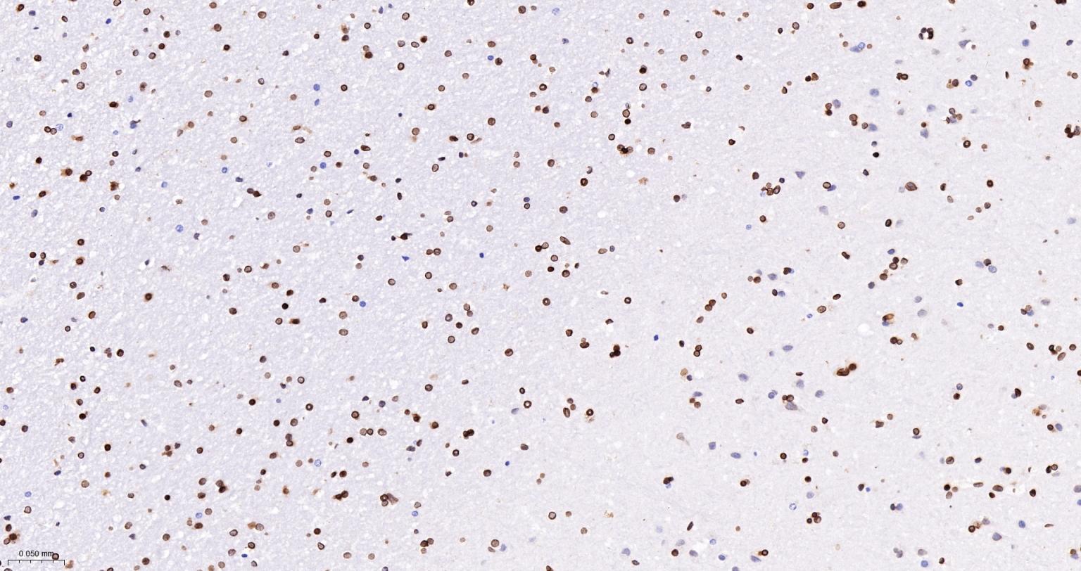 核纤层蛋白A/C单克隆抗体-bsm-51683M