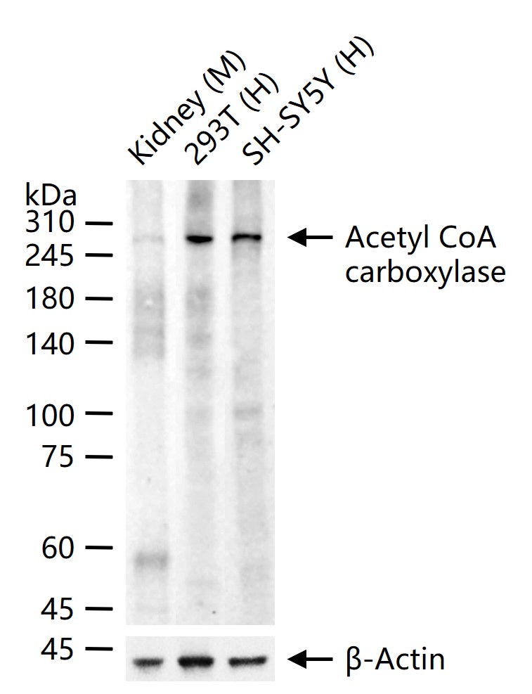 乙酰辅酶A羧化酶重组兔单抗