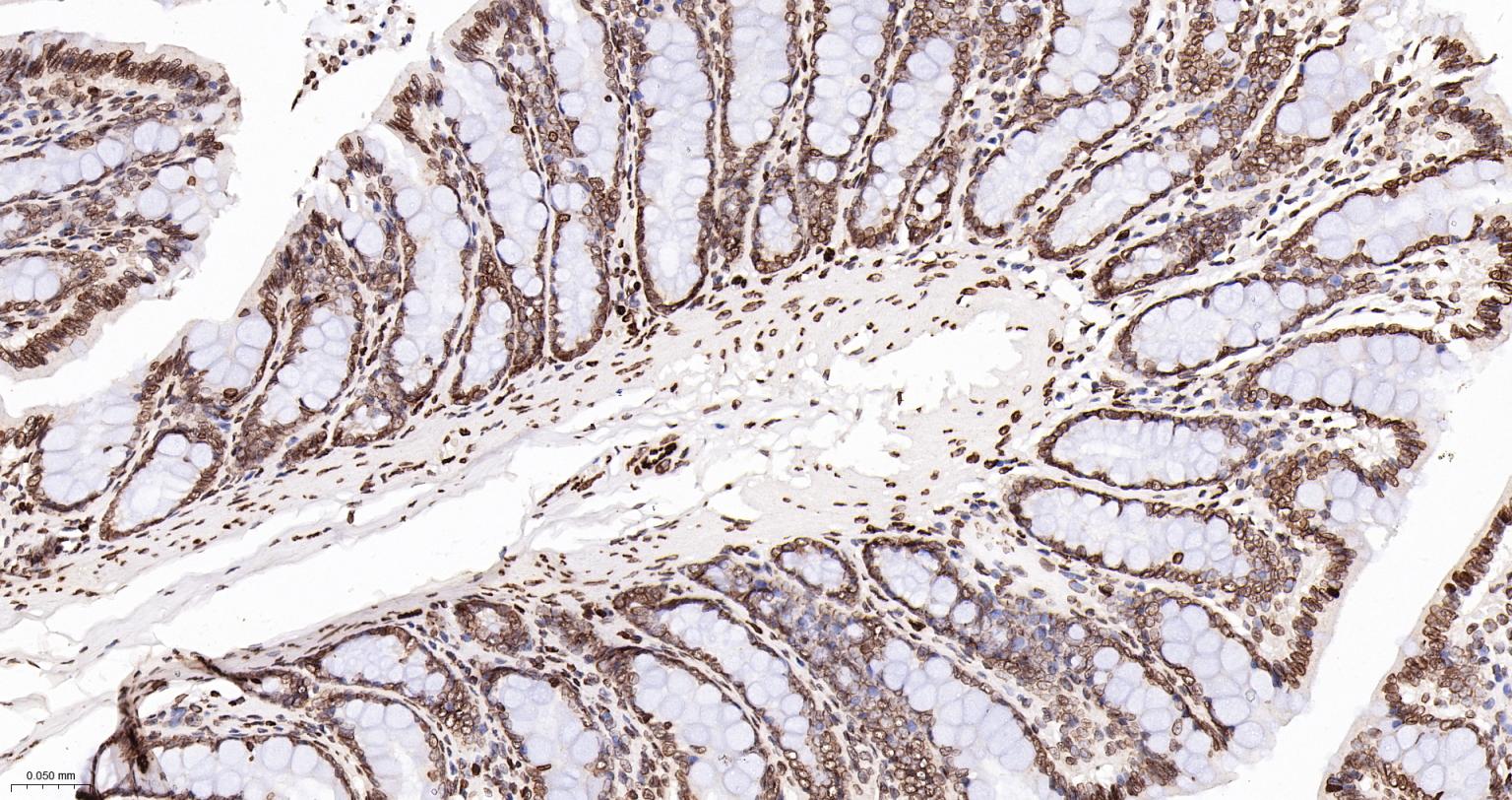 核纤层蛋白A抗体-bsm-34042M