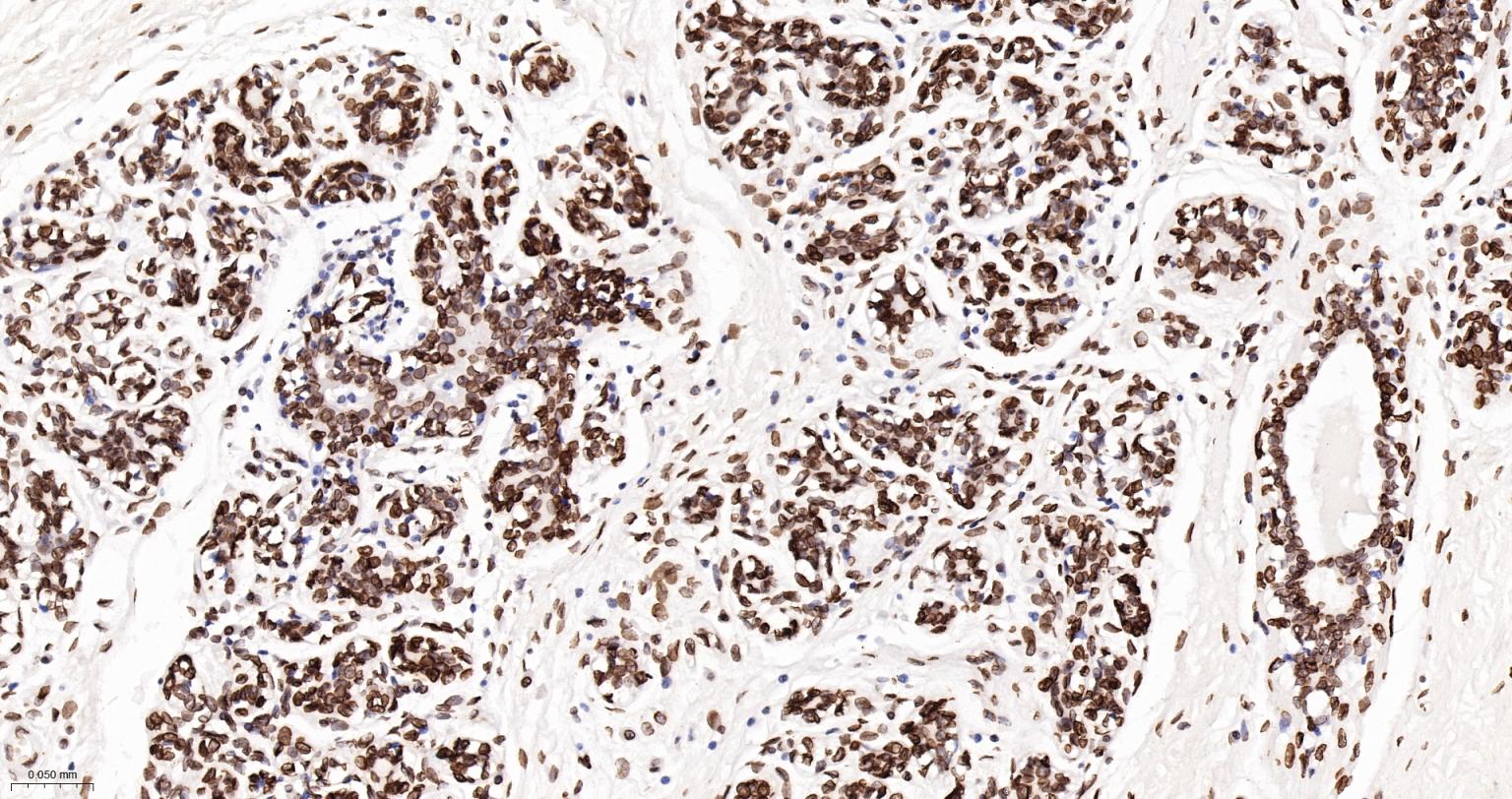 核纤层蛋白A抗体-bsm-34042M