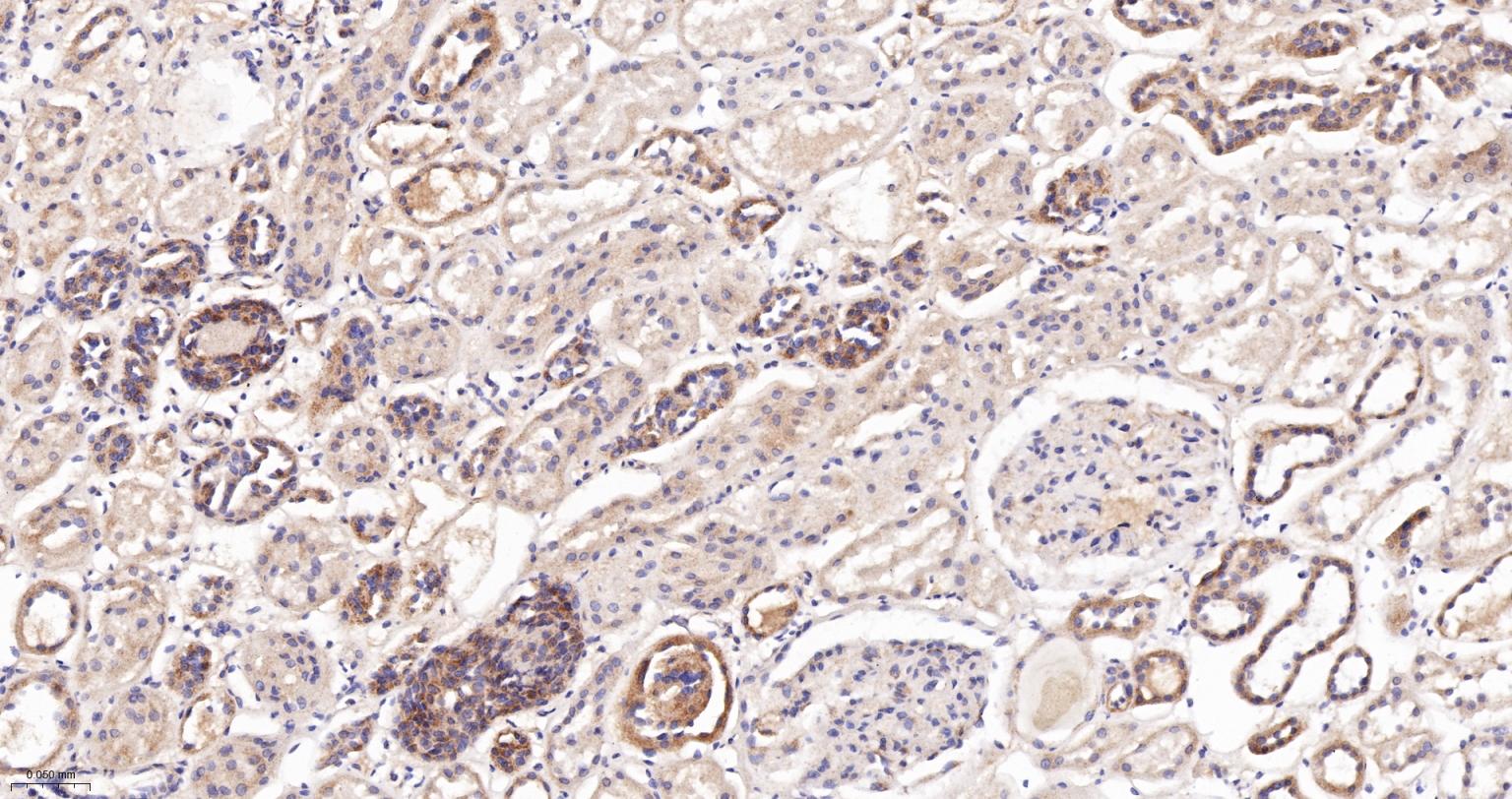 NDUFS2重组兔单抗
