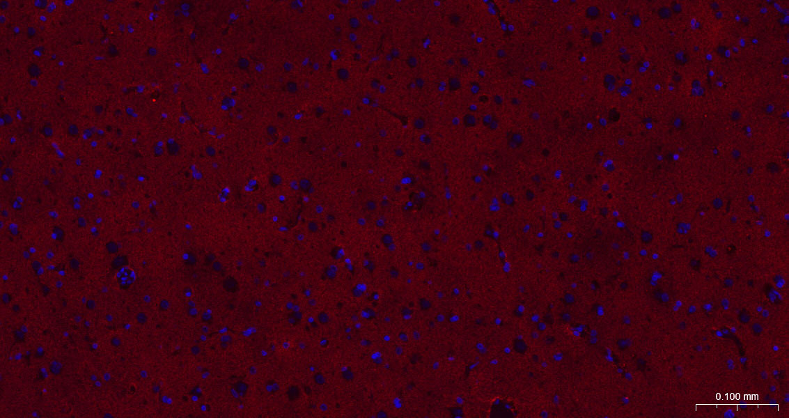 胶质细胞谷氨酸运载蛋白1重组兔单抗