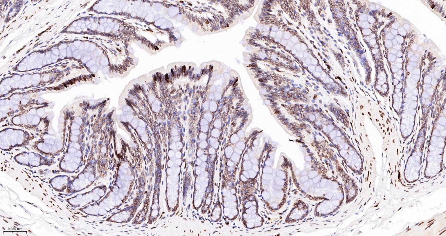 核纤层蛋白A/C单克隆抗体-bsm-51683M