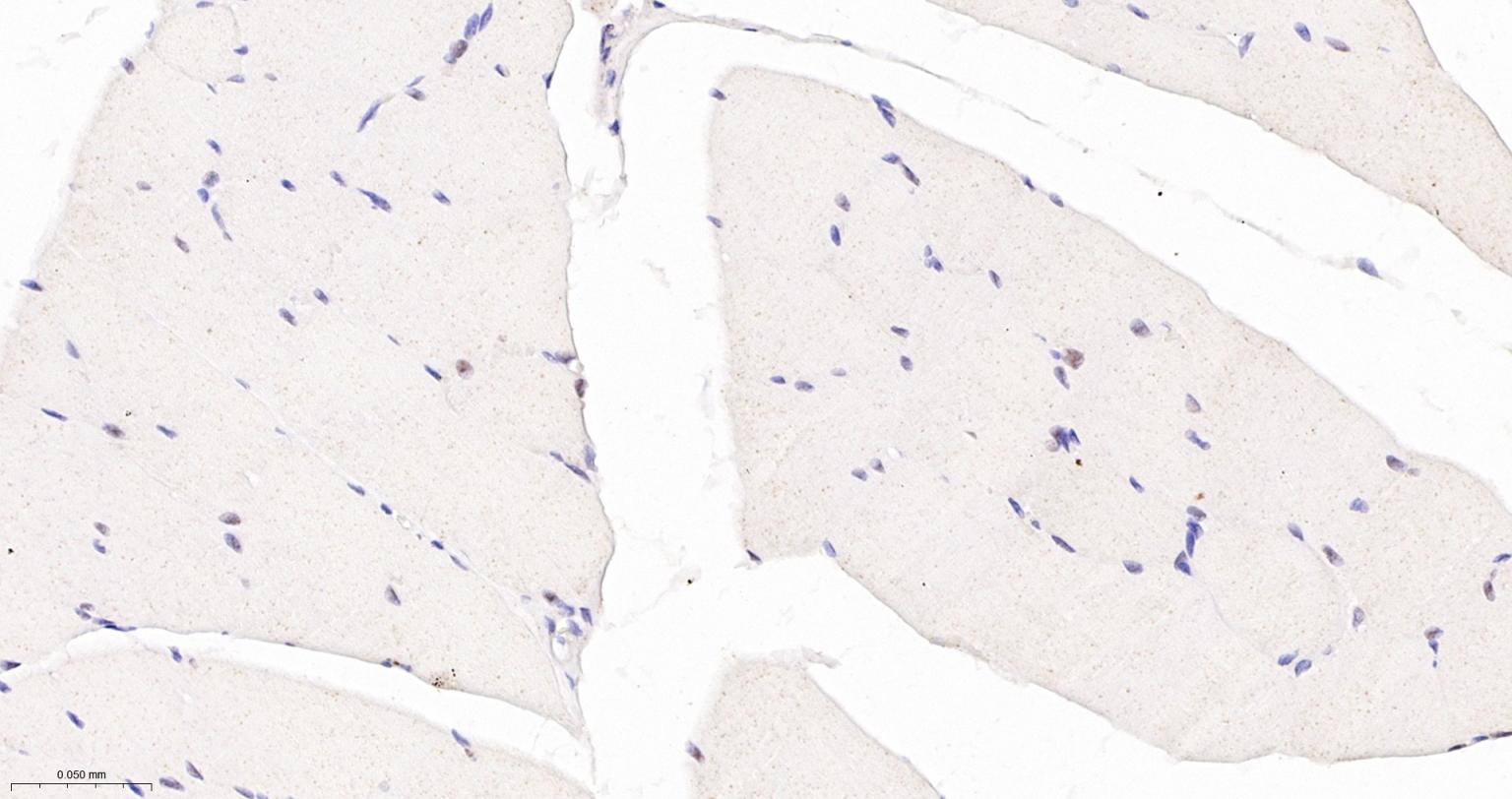 TEAD1重组兔单抗