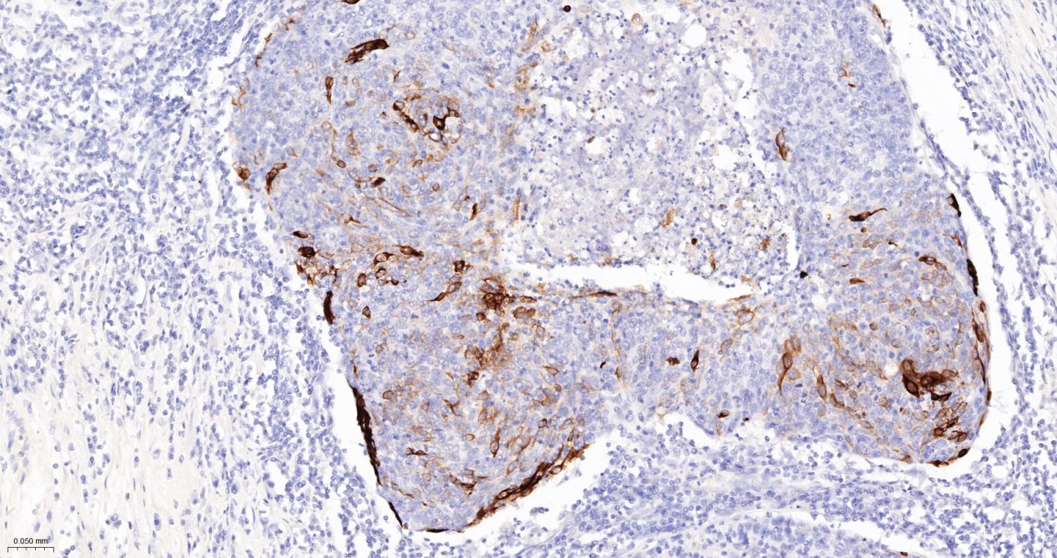 细胞角蛋白10重组兔单抗