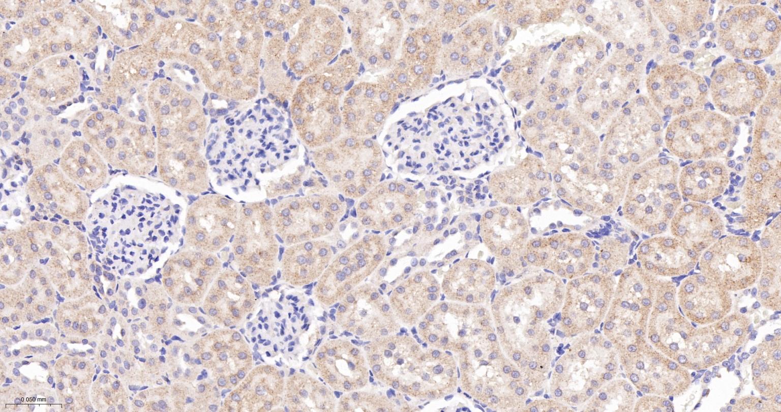 NDUFS2重组兔单抗