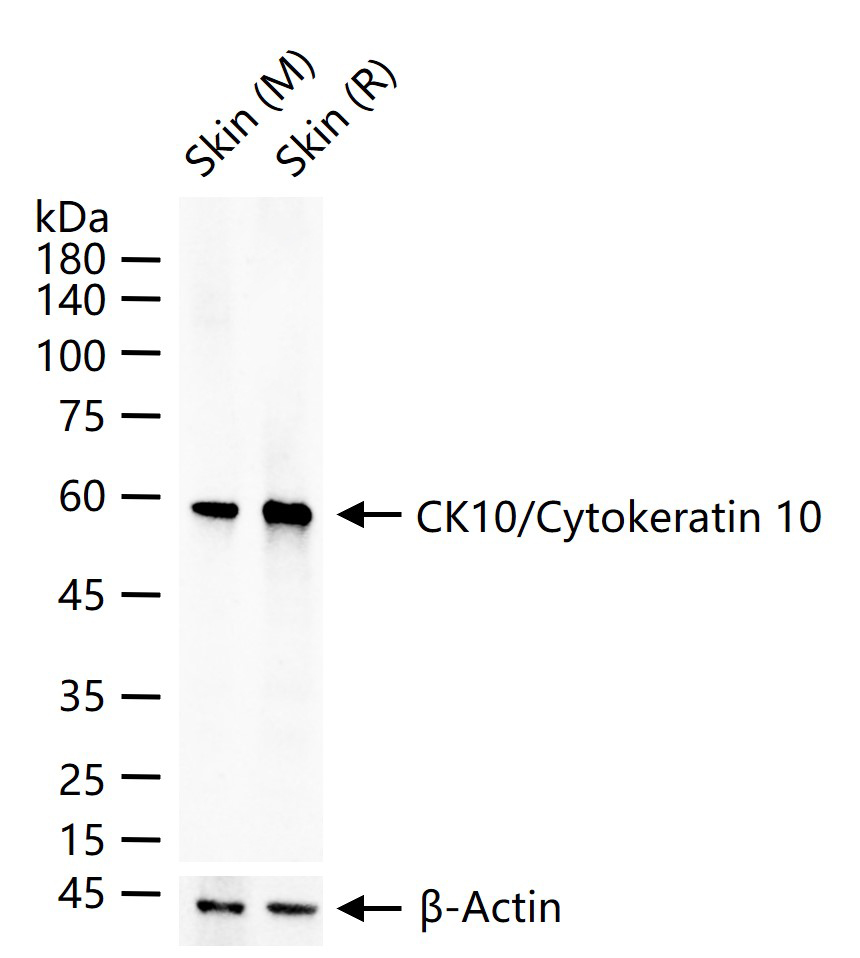细胞角蛋白10重组兔单抗