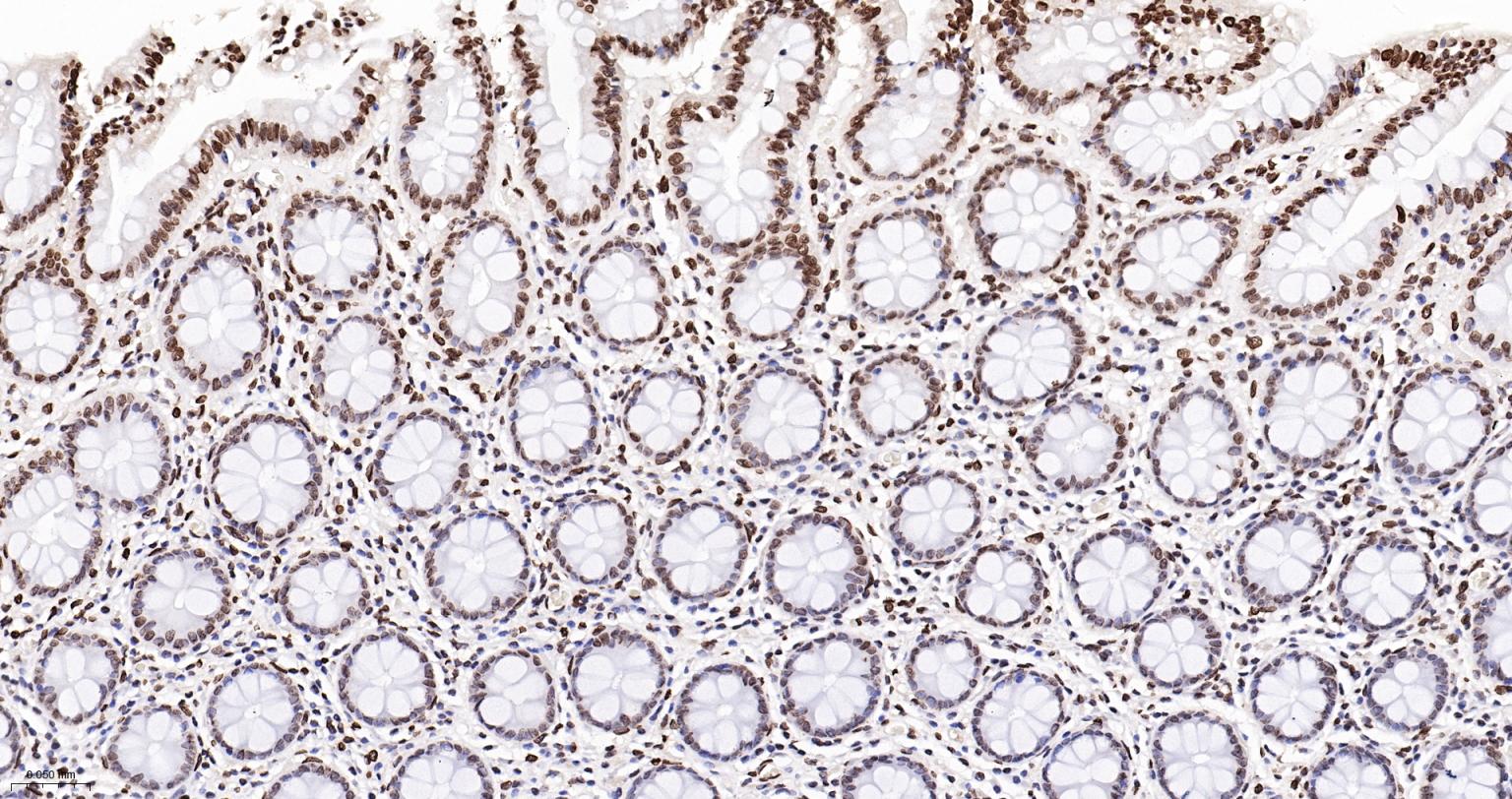 核纤层蛋白A抗体-bsm-34042M