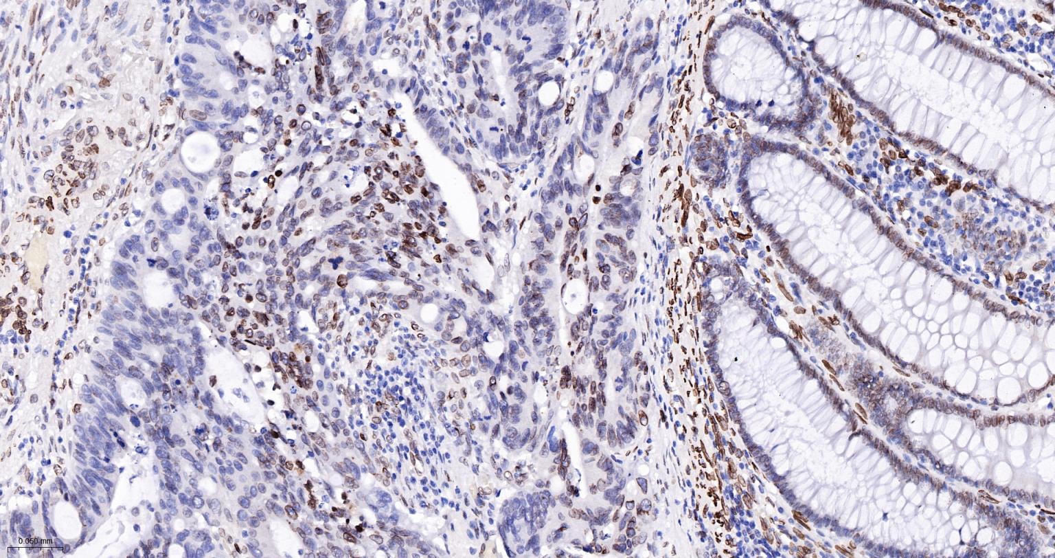 核纤层蛋白A/C单克隆抗体-bsm-51683M