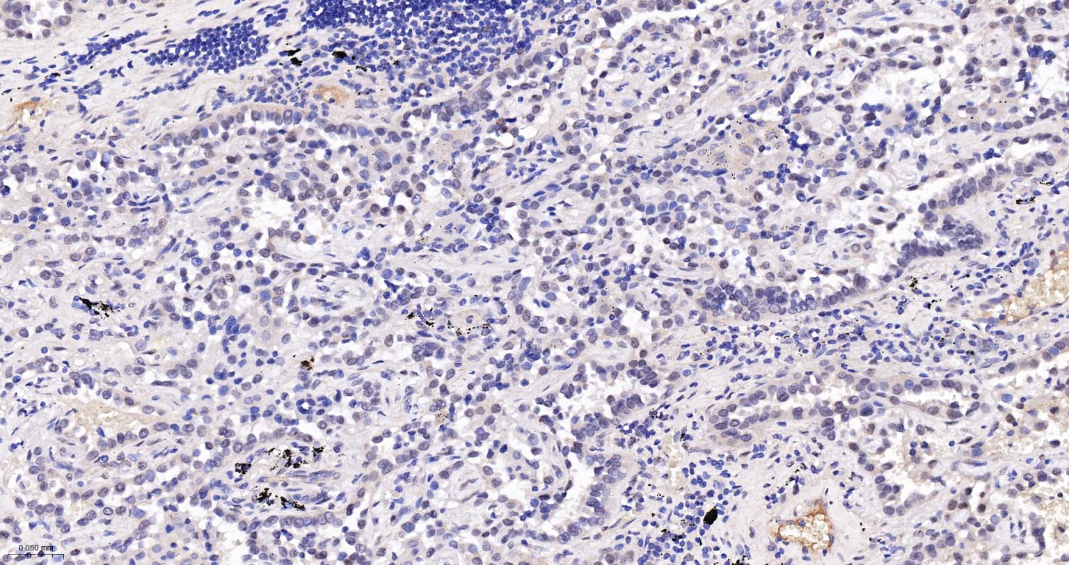 TEAD1重组兔单抗