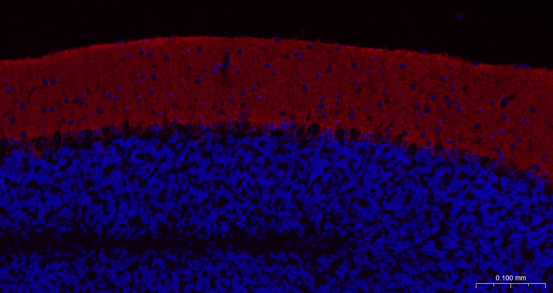 胶质细胞谷氨酸运载蛋白1重组兔单抗