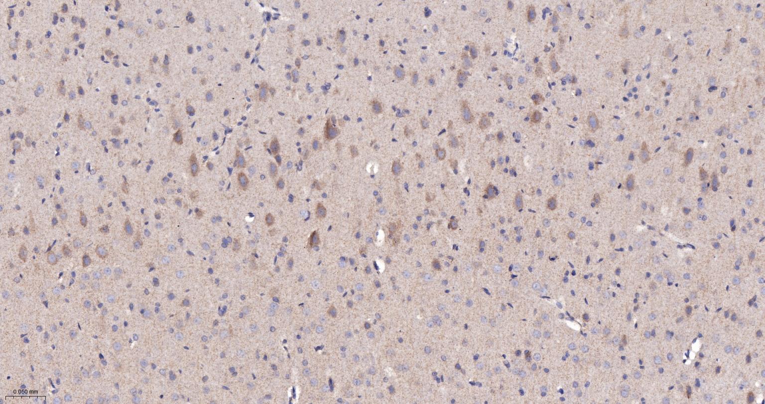 NDUFS2重组兔单抗