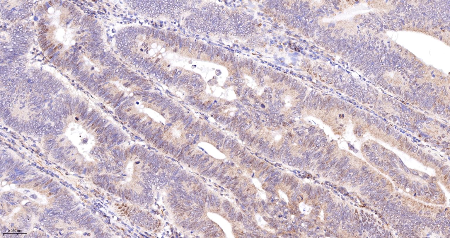 受体激活蛋白激酶C1重组兔单抗