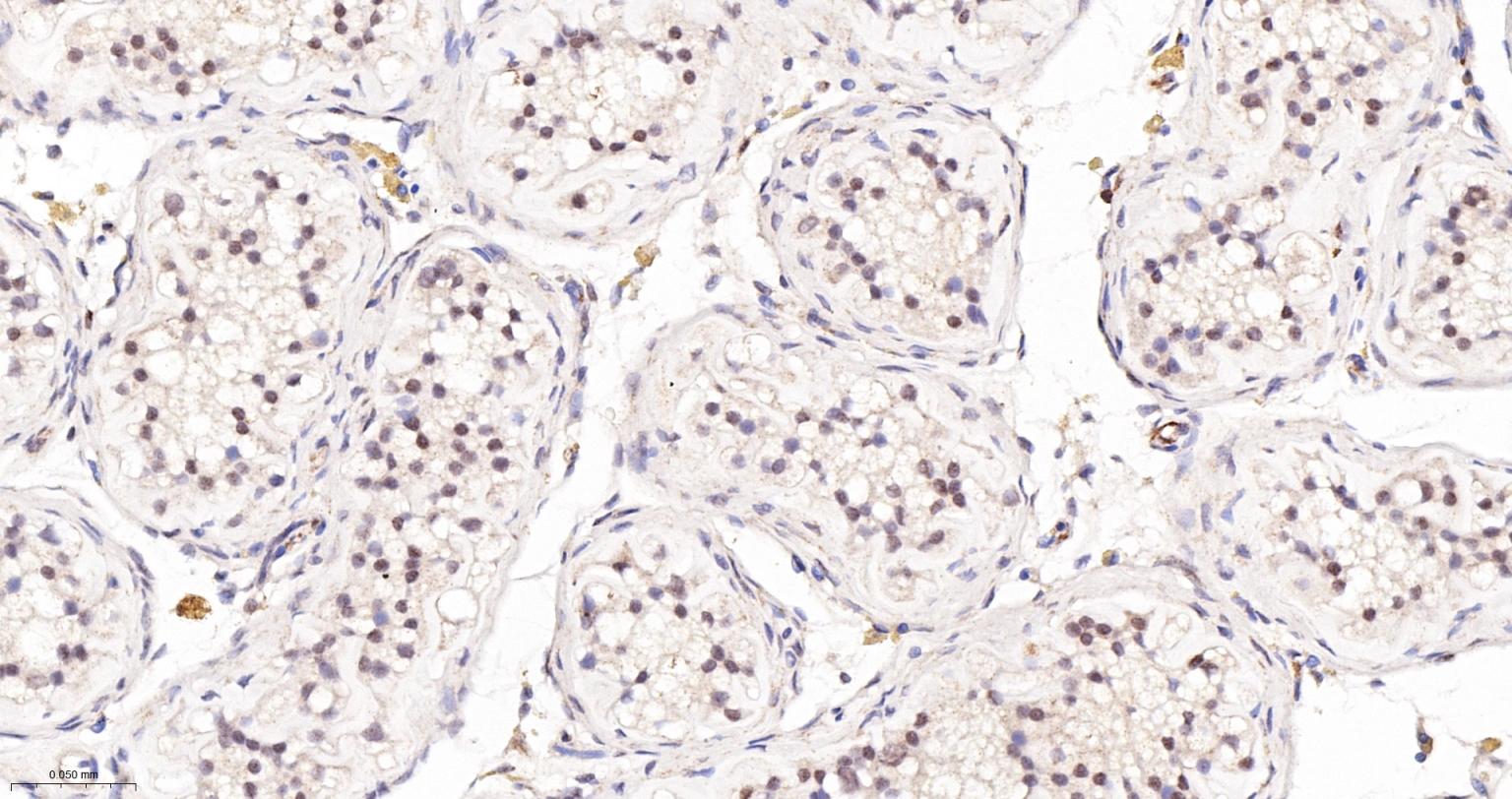 受体激活蛋白激酶C1重组兔单抗