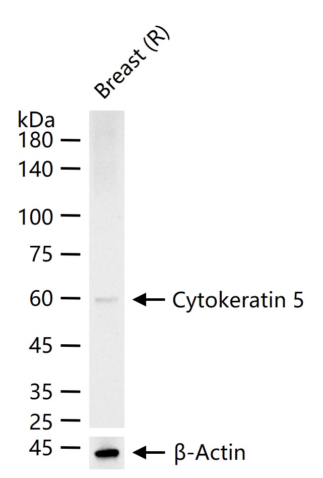 细胞角蛋白5重组兔单抗