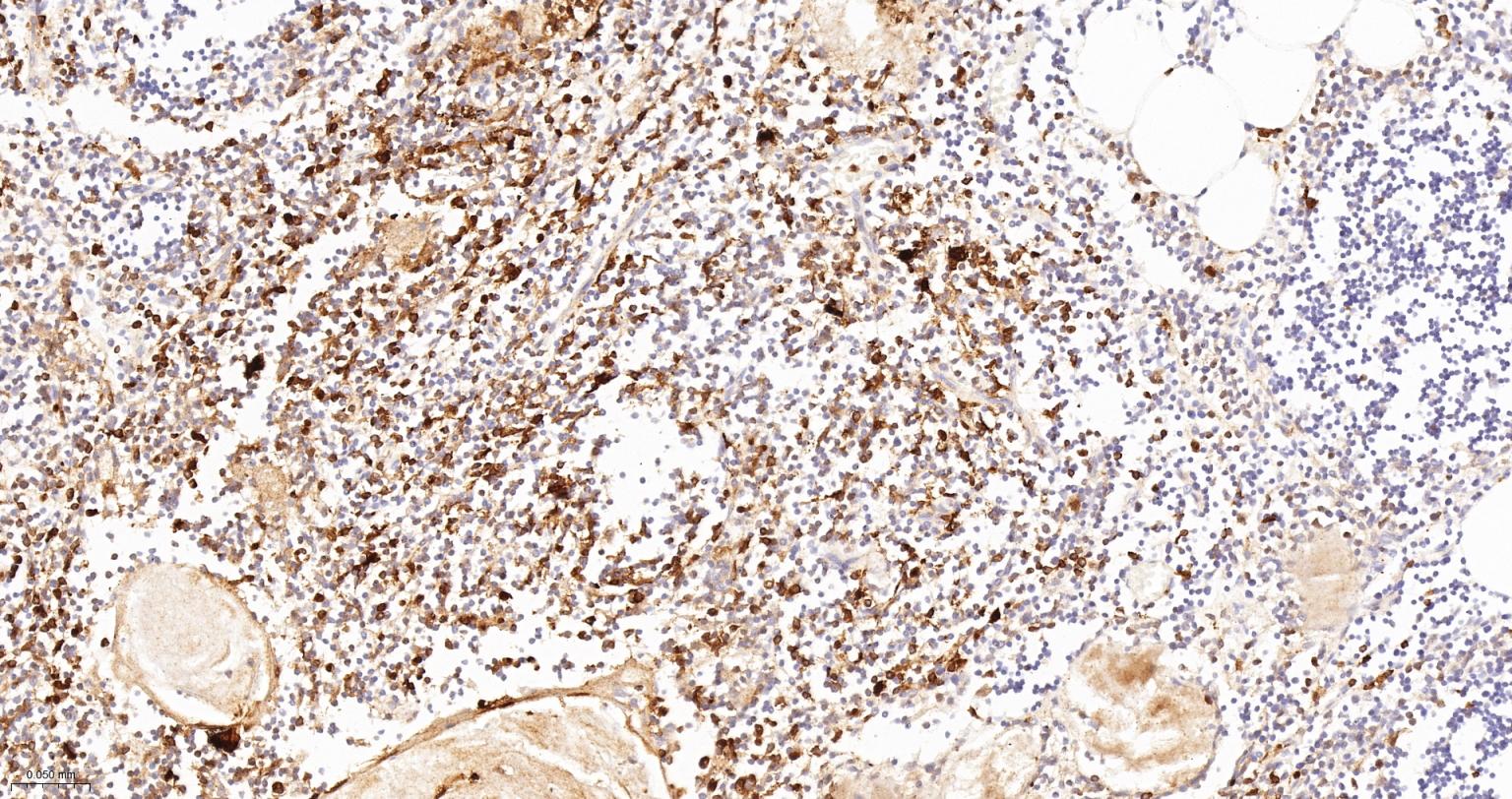 FC段γ受体3/免疫球蛋白G Fc段受体III重组兔单抗