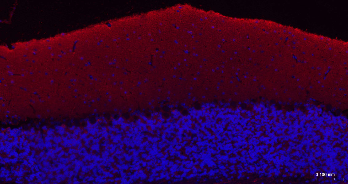 神经生长相关蛋白43重组兔单克隆抗体