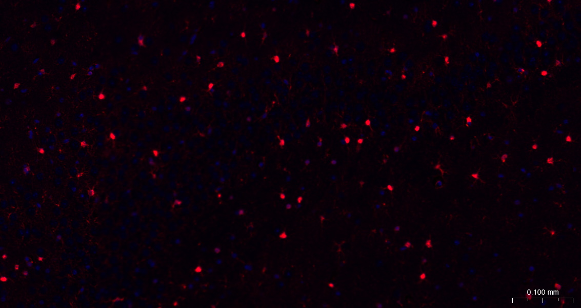 S100B蛋白重组兔单抗