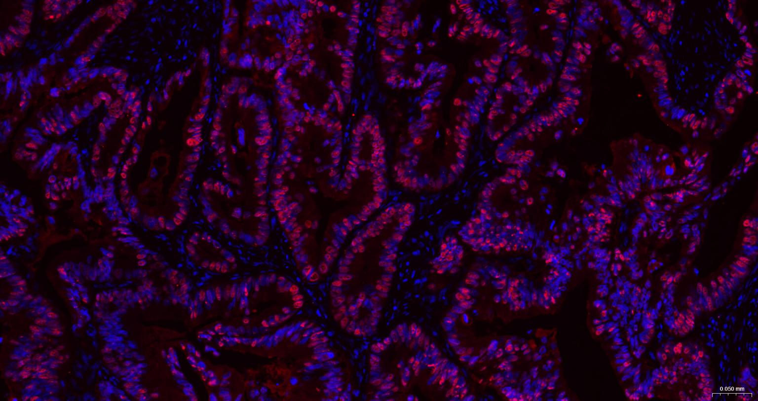 转录因子SOX9蛋白重组兔单抗