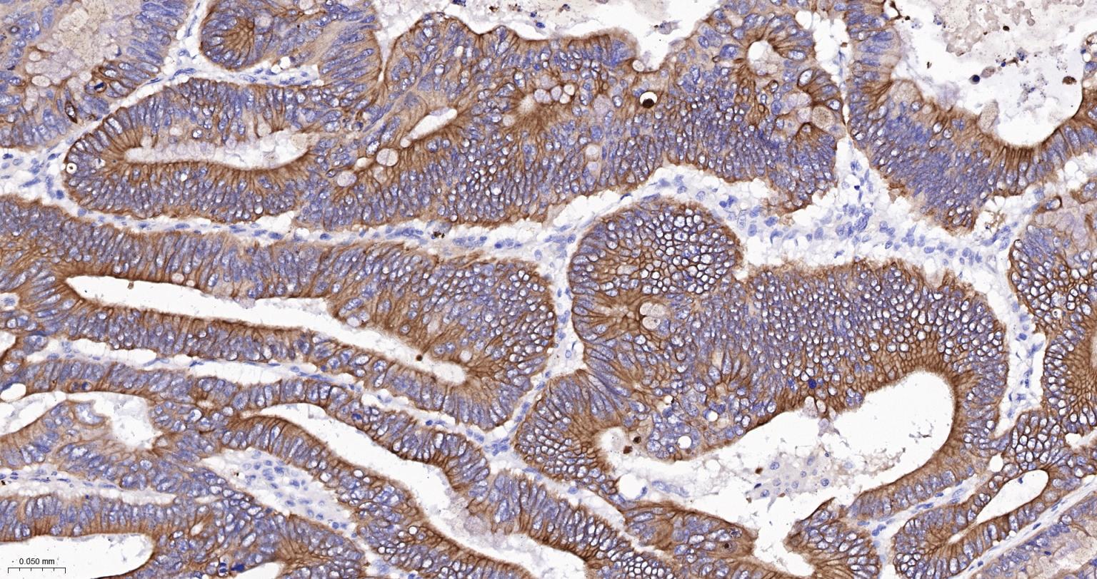 细胞角蛋白18单克隆抗体-bsm-33103M