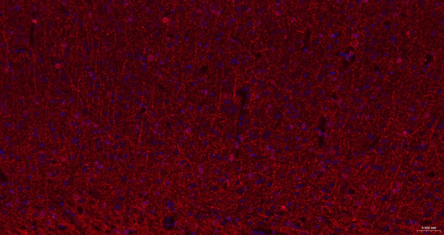 2’,3’-环腺苷酸-3’-磷酸二酯酶重组兔单抗-bsm-61411R