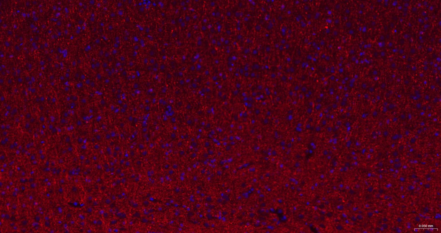 2’,3’-环腺苷酸-3’-磷酸二酯酶重组兔单抗-bsm-61411R