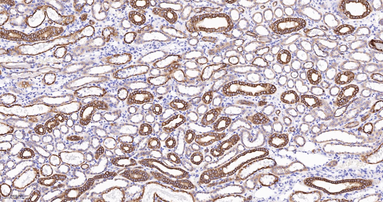 细胞角蛋白18单克隆抗体-bsm-33103M