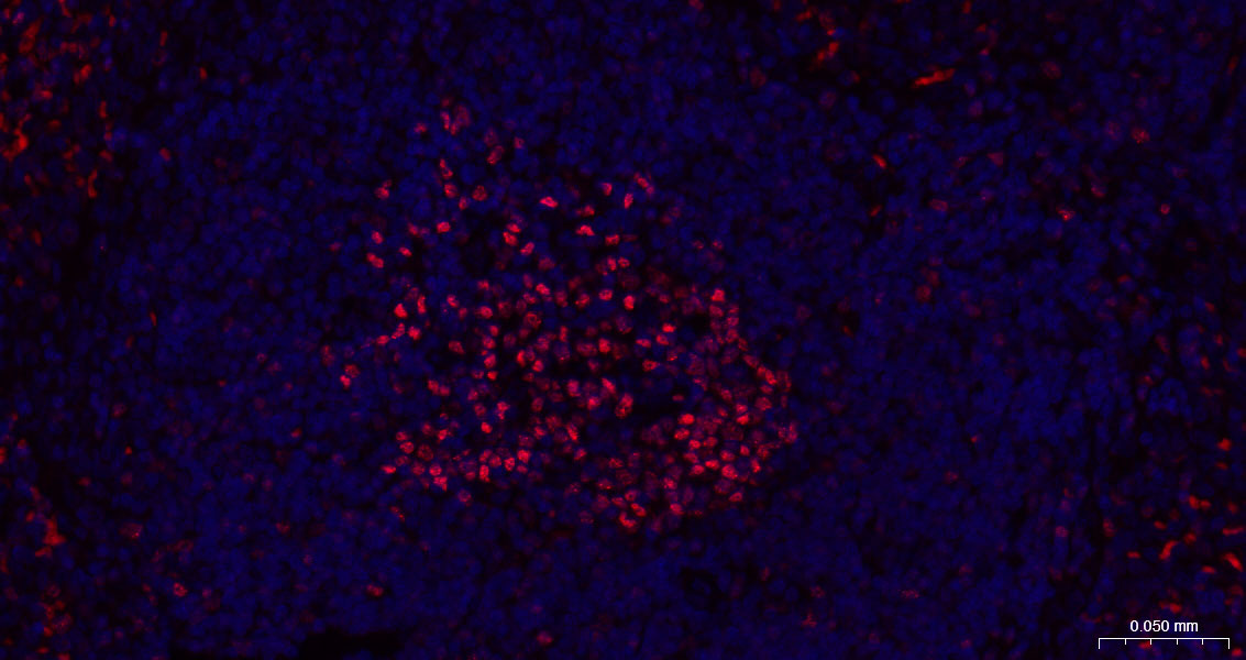 抑癌蛋白EZH2重组兔单抗