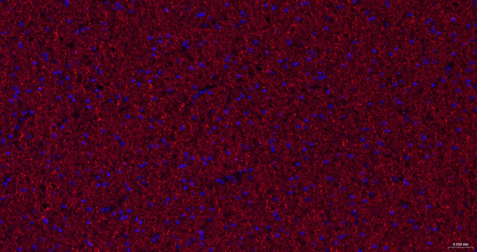 2’,3’-环腺苷酸-3’-磷酸二酯酶重组兔单抗-bsm-61411R