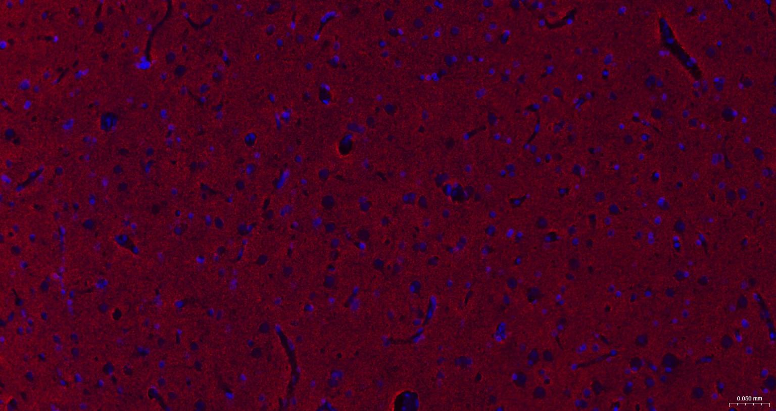 神经生长相关蛋白43重组兔单克隆抗体
