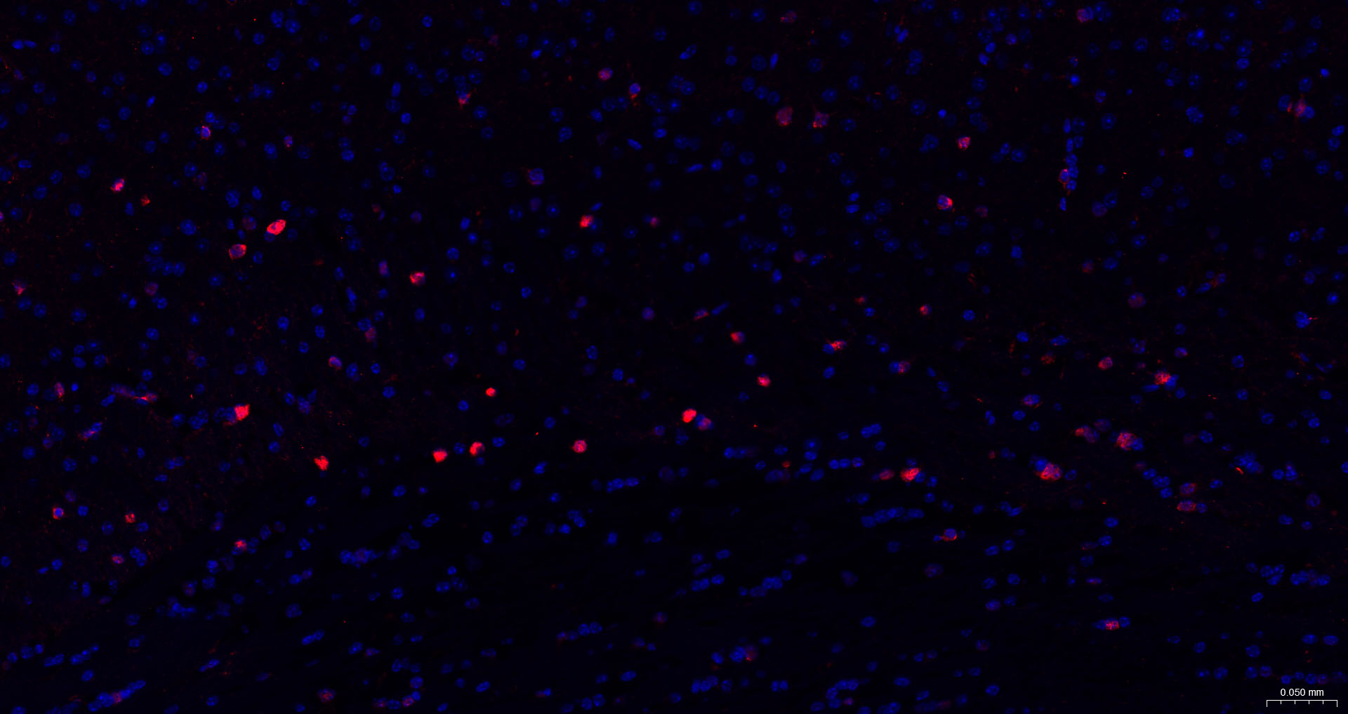 S100A1重组兔单抗-bsm-63045R