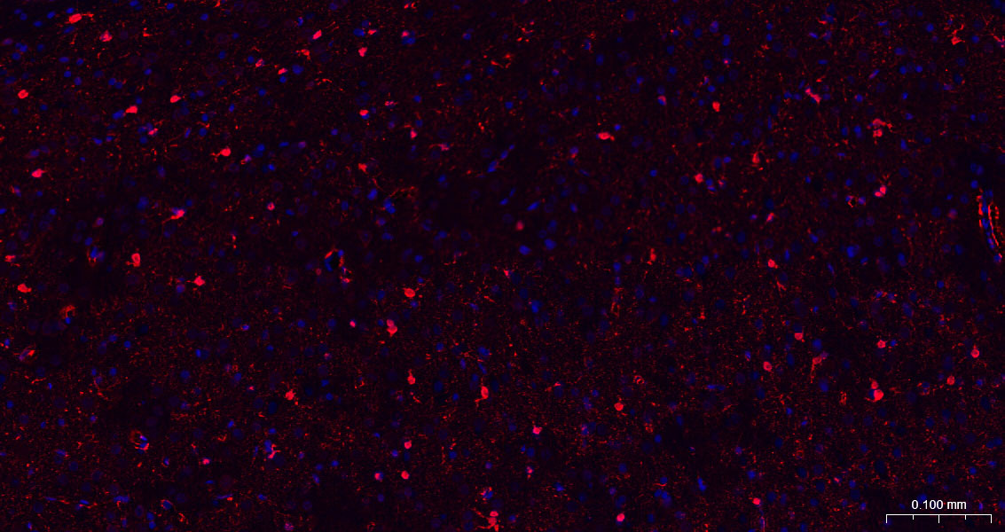 S100B蛋白重组兔单抗