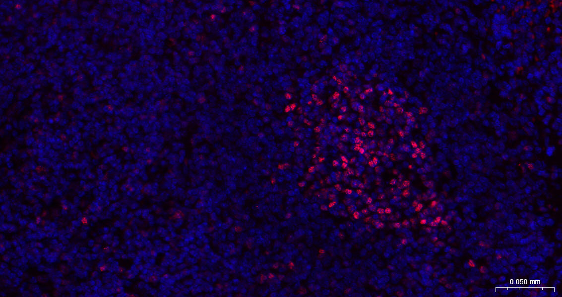 抑癌蛋白EZH2重组兔单抗