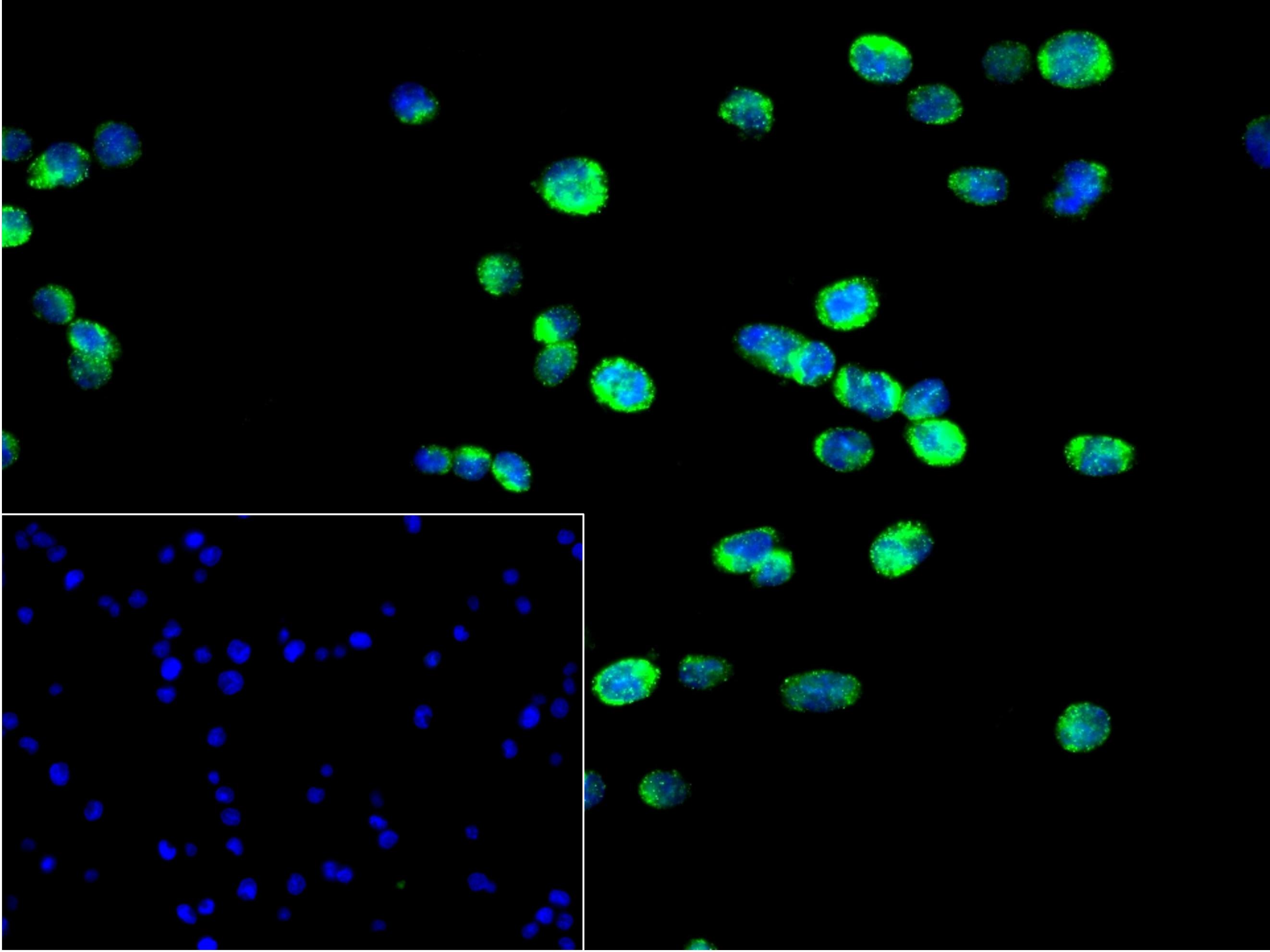 Bcl-2同源拮抗剂重组兔单抗