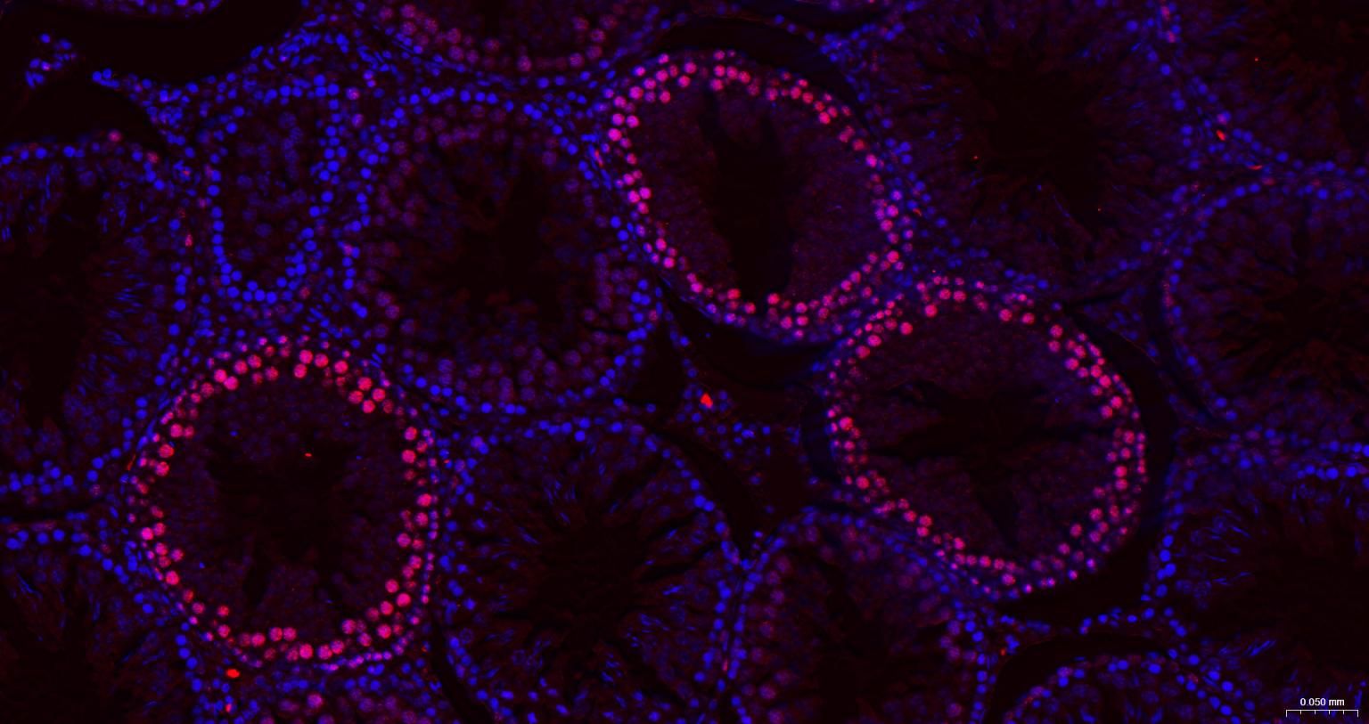 抑癌蛋白EZH2重组兔单抗