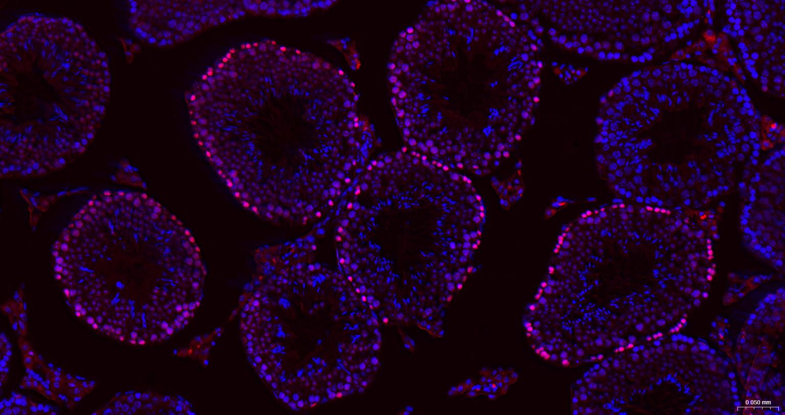 抑癌蛋白EZH2重组兔单抗