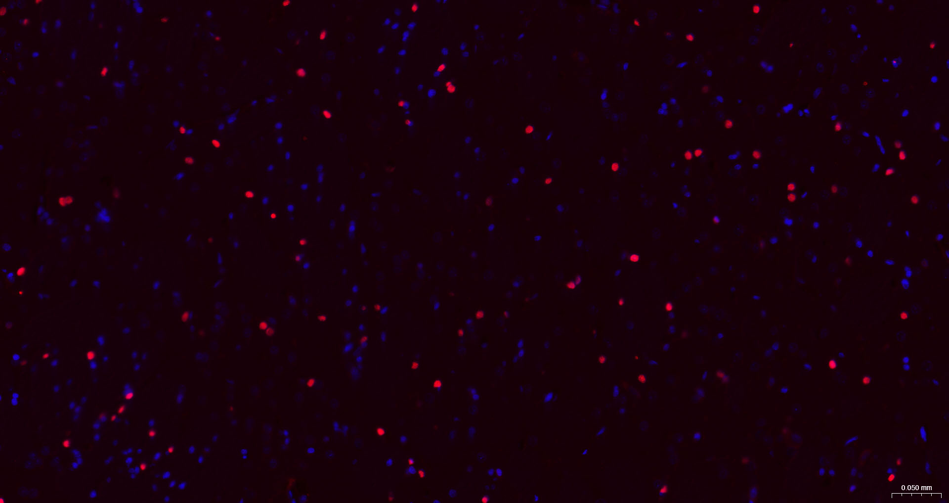 转录因子SOX9蛋白重组兔单抗